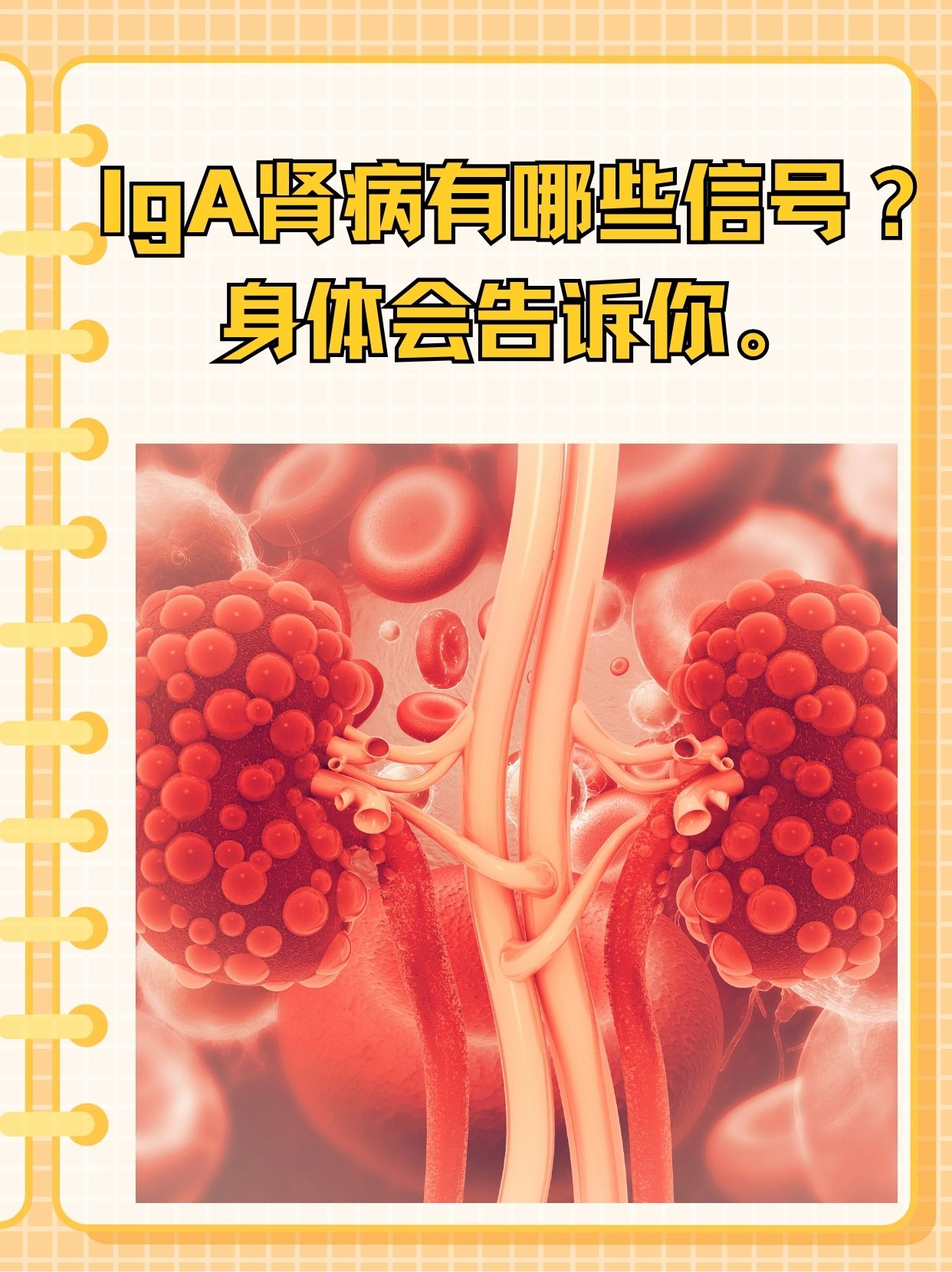 我国首部《IgA肾病临床实践60问(2026版)》正式发布 打造临床“口袋工具书”